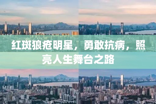 红斑狼疮明星，勇敢抗病，照亮人生舞台之路